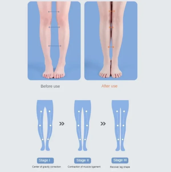 Orthotic Insoles For Flat Feet Arch Support Orthopedic Shoes Sole PU Insoles For Feet Men Women O/X Leg Corrected Care Pad - Image 5