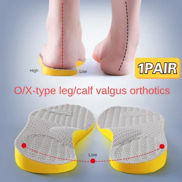Orthotic Insoles For Flat Feet Arch Support Orthopedic Shoes Sole PU Insoles For Feet Men Women O/X Leg Corrected Care Pad - Image 2