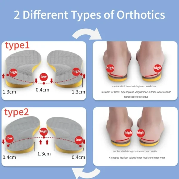 Orthotic Insoles For Flat Feet Arch Support Orthopedic Shoes Sole PU Insoles For Feet Men Women O/X Leg Corrected Care Pad - Image 3